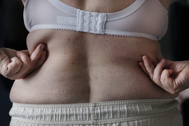 Surpoids et obésité : quelles sont les causes ?